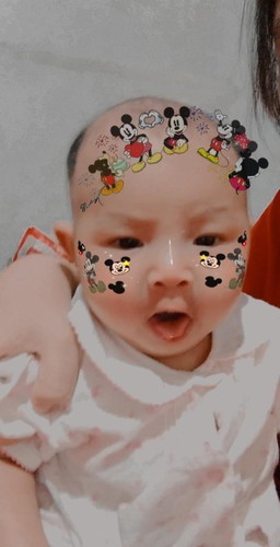 ติมตามพัฒนาการ
