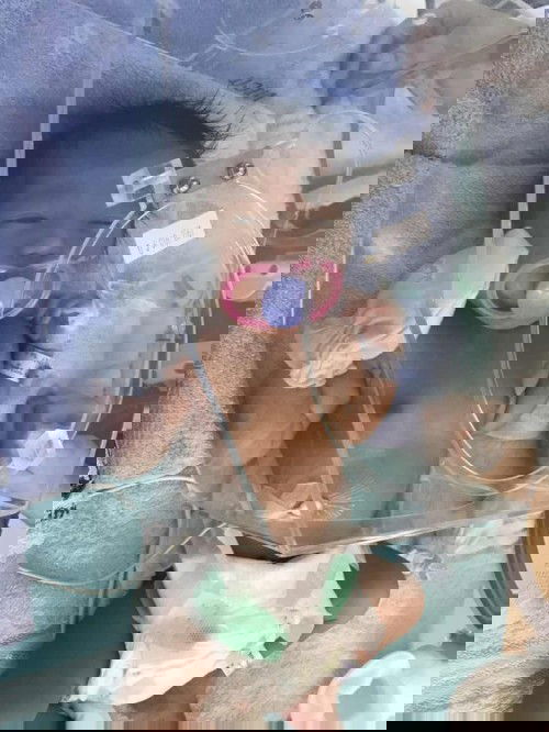 อัพเดตอาการลูกชายค่ะ จากเมื่อวานที่ผ่าคลอดแล้วหายใจเร็ว+ติดเชื้อ ตอนนี้น้องดีขึ้นแล้วค่ะ