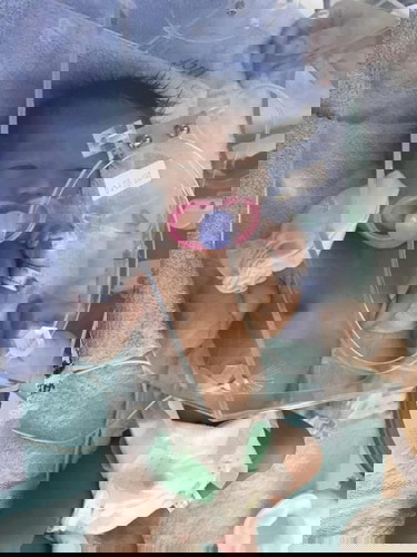 อัพเดตอาการลูกชายค่ะ จากเมื่อวานที่ผ่าคลอดแล้วหายใจเร็ว+ติดเชื้อ ตอนนี้น้องดีขึ้นแล้วค่ะ