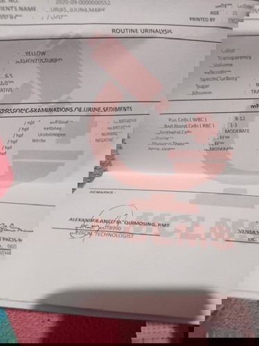 may nakakaalam po b ang results ng urninalysis ko mga sis