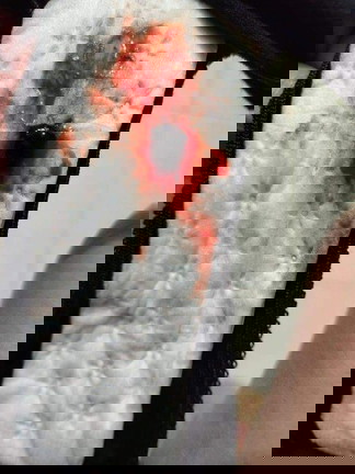 Bloody discharge