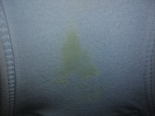 Help please. Vaginal Discharge.