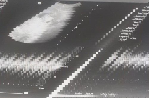 ตื้นตันใจกับรูปนี้