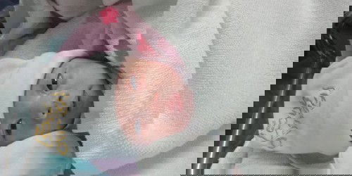 แตกแล้วจ้าาา