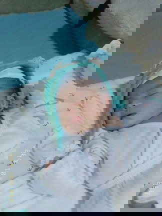 Premature baby