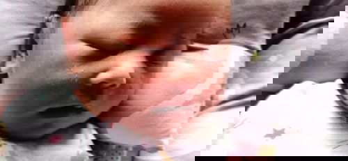 Ruam Pipi bayi 6 hari