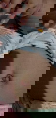 namumula pusod ng baby namin