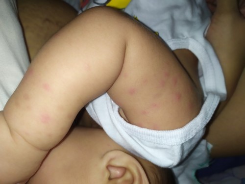 Cream for rashes/allergies