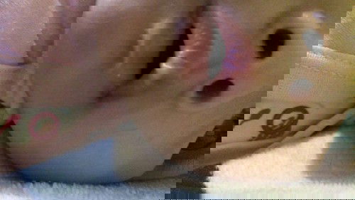 Bintik putih di bibir