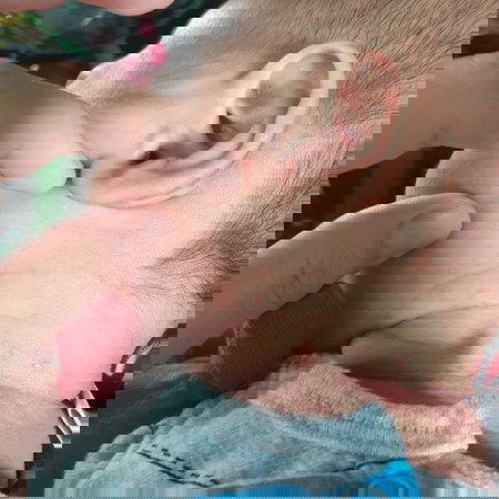 ลูกมีตุ่มขึ้นรอบคอ