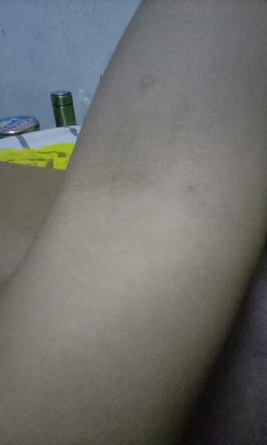 Ambil darah untuk lab