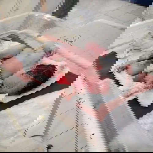 Induction birthing experience