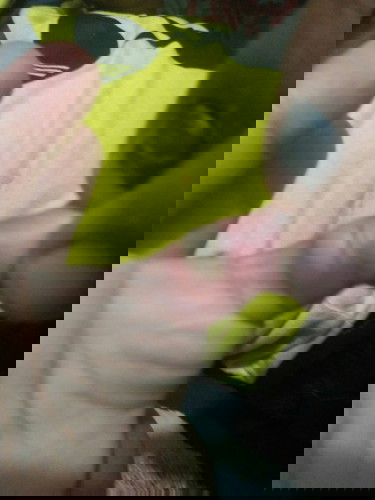 kira2 kena apa ya bun tangan anak saya?