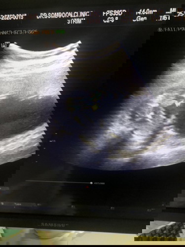 สอบถามภาพอัลตร้าซาวด์