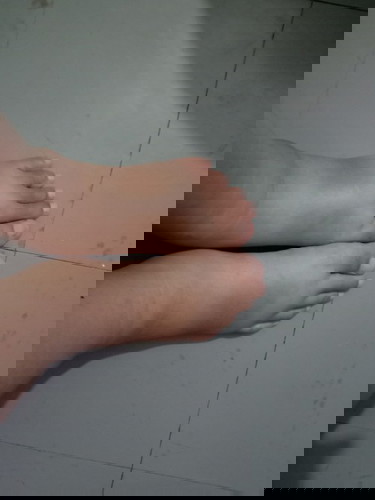 เท้าบวมหลังคลอดปกติไหม