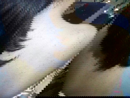 มีแม่ๆคนไหนไหนเป็นบ้างคะ