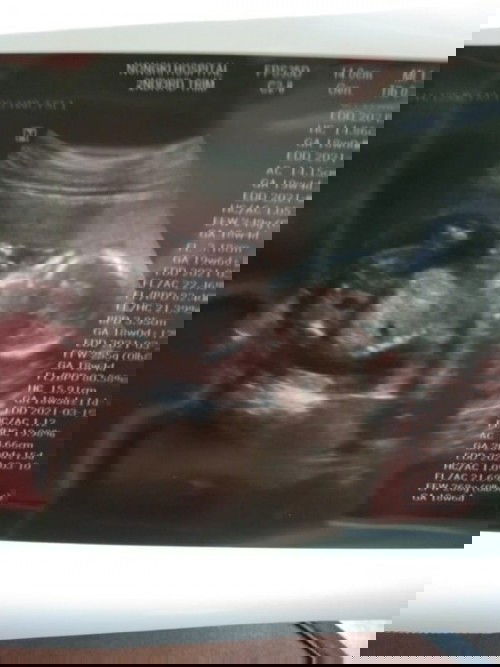 บ้านนี้5เดือนแร้วจ้า