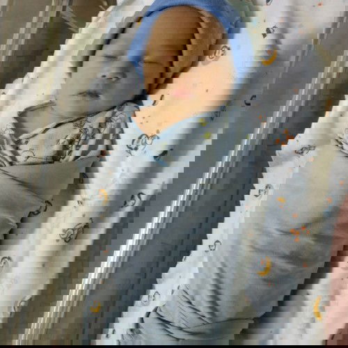 Bilirubin 12.1 . Mohon do'anya ya bunda