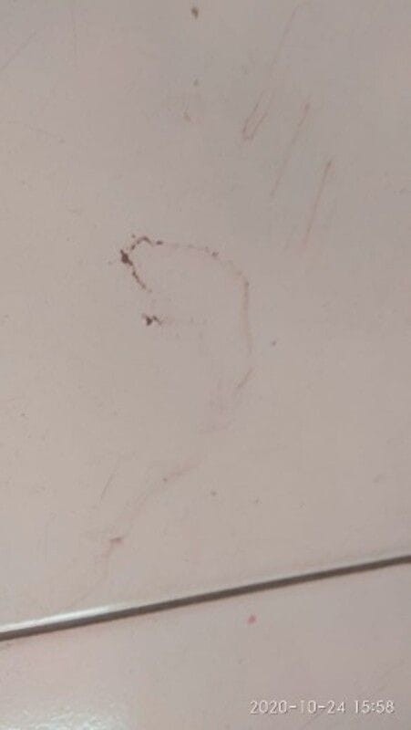 Gangguan "gaib" saat hamil  (1)