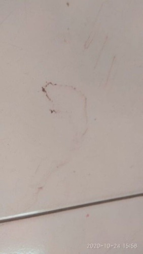 Gangguan "gaib" saat hamil (1)