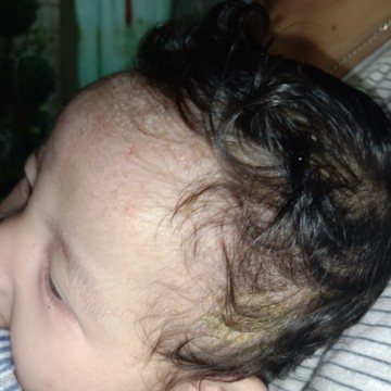 Need tips po.
Two months napo pamangkin ko pero may langib na makapal padin po Ang kanyang ulo.