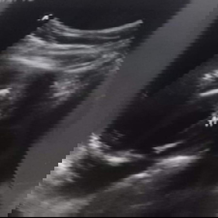 ผู้หญิงหรือผู้ชาย