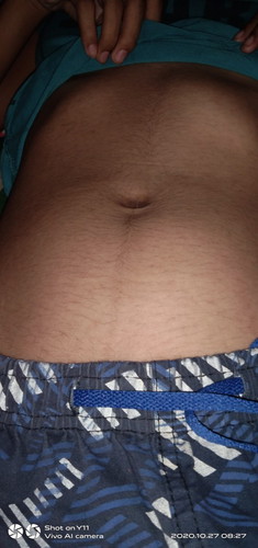 Size ng tummy