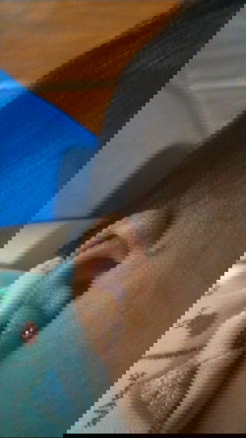 Daun Telinga berkerak n bau