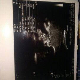 อยากรู้ว่านี้คือส่วนไหนของลูกบ้าง