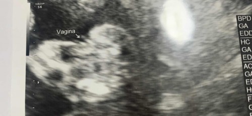 ผู้หญิง 100% มั้ยคะ