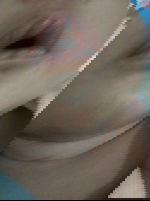 bibir kering dan putih2