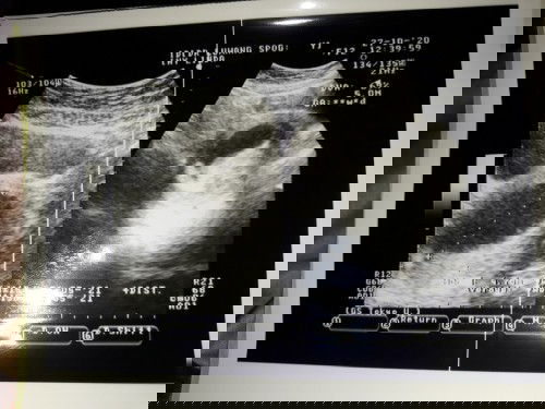 Keluar darah dan lendir