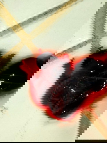 Blighted Ovum Miscarriage (natural way) ano nga ba ang itsura?