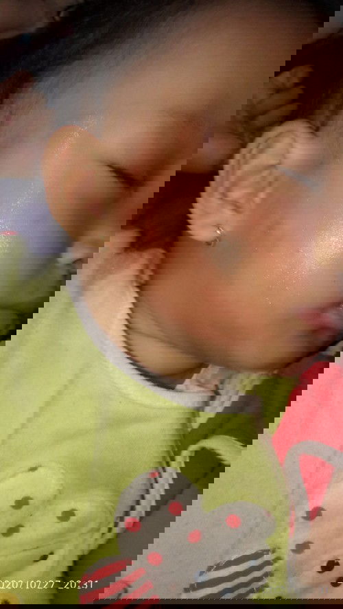 Pipi merah ketika tidur miring kelamaan