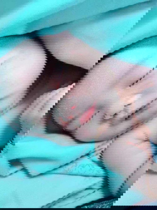 น้องสำสักน้ำขี้เทาหายใจเร็ว!!