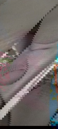 ลูกชาย8เดือนแพ้แพมเพิส