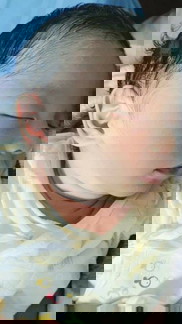 คลอดแล้วค่ะคลอดตอน38w5d