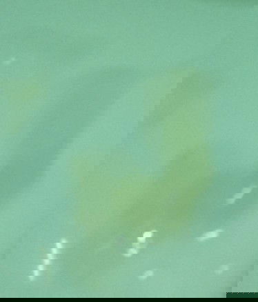 อายุครรภ์ 39+4