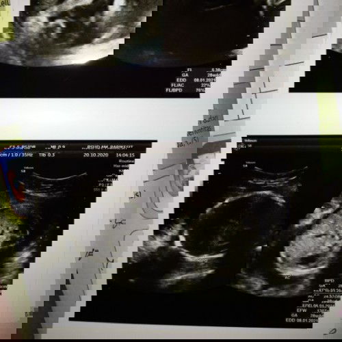 Keinginan manusia dan ketentuan Tuhan tak selalu sama