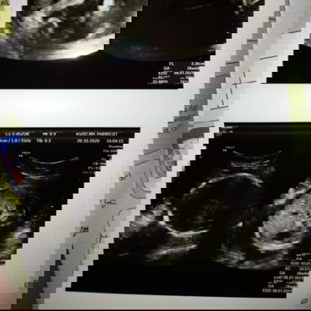 Keinginan manusia dan ketentuan Tuhan tak selalu sama