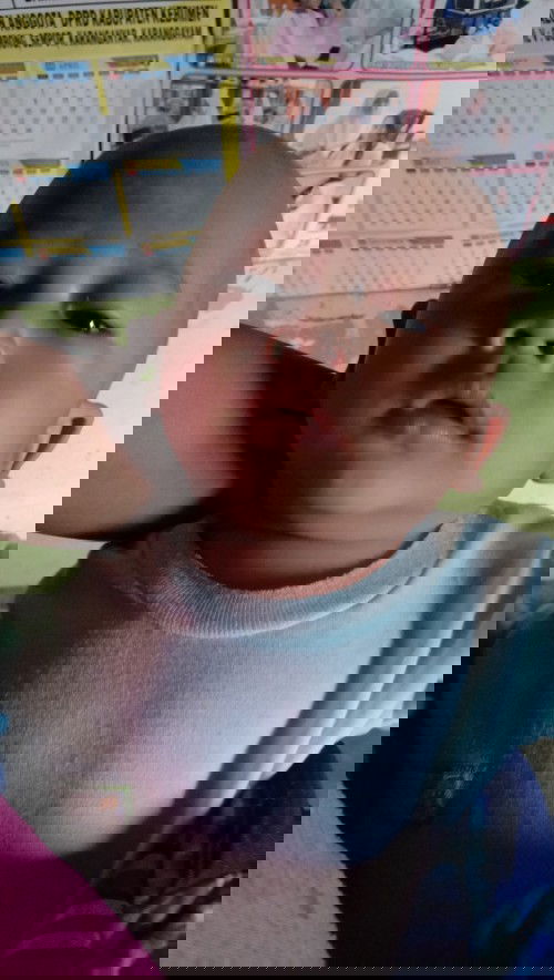 Putih2 d dahi,4bln 21hari