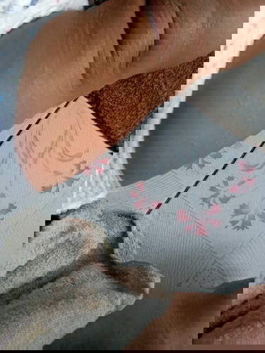 แบบนีัเป็นอะไรไหม🤨