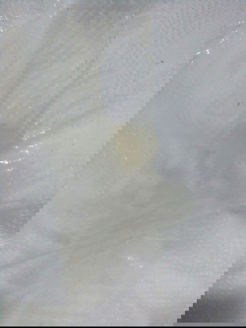 C.mom oi sag ngu day thấy ra như vậy co phải bung nut nhầy k. E 37t 3ng tập đầu nên k bit.