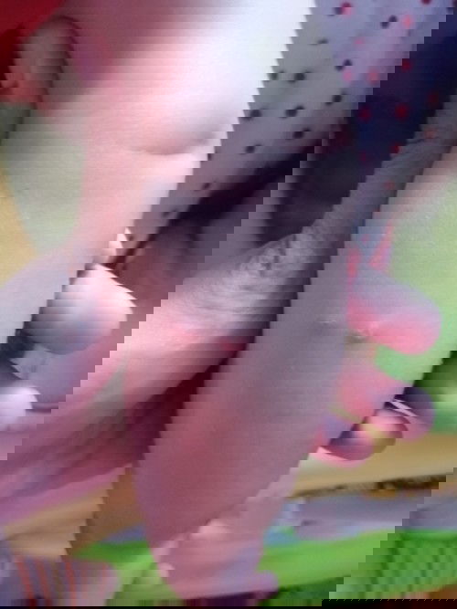 นี่ตุ่มอะไรหรอคะ