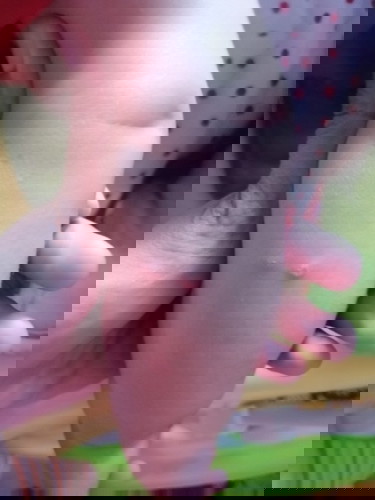 นี่ตุ่มอะไรหรอคะ