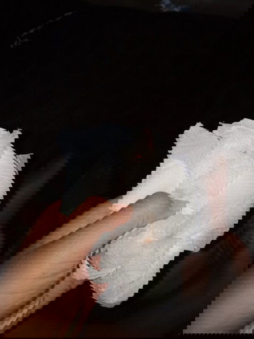 แบบนี้ใช่มูกเลือดมั้ยคะ 37+1