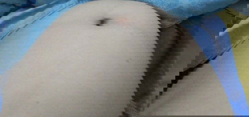 ท้องปั้นบ่อยมาก