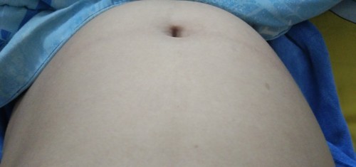 ท้องปั้นบ่อยมาก