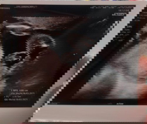 เพศไหนเอ่ย??