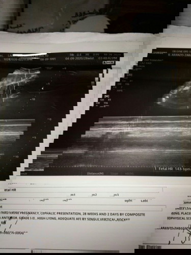 BPS RESULTA